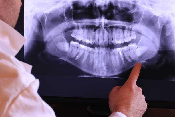 Best Chipped Tooth Repair Near Me  in White Meadow Lake, NJ